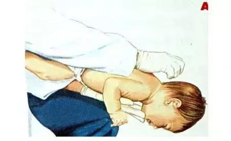 吃东西呛到怎么补救,吃东西呛到了急救方法叫什么