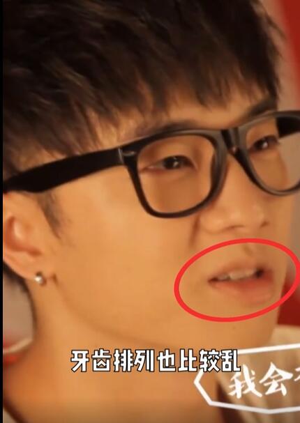 美妆网红晒华晨宇变脸过程质疑其做了3项整容手术，真的不怕被告