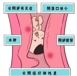 说一个你内心难以启齿的小秘密,女生有哪些让你难以启齿的病