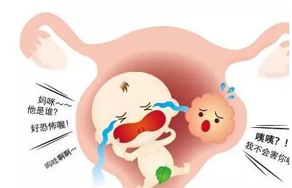 阴道炎会导致胎儿早产？孕期一定要注意这些细节