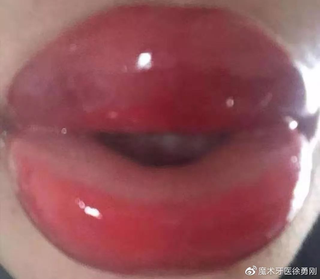 内行人为什么不建议漂唇,作为一名医生一直被人质疑