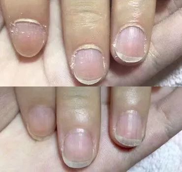 冬季皲裂膏预防脚后跟干裂好用的,上热门脚后跟干裂保湿霜