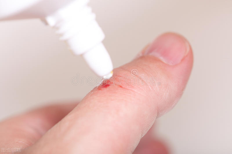 伤口酒精和碘伏哪个消毒效果好,皮肤消毒用酒精和碘伏区别