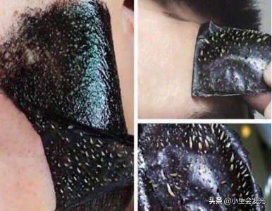 强力祛痘祛黑头,怎样祛鼻子黑头