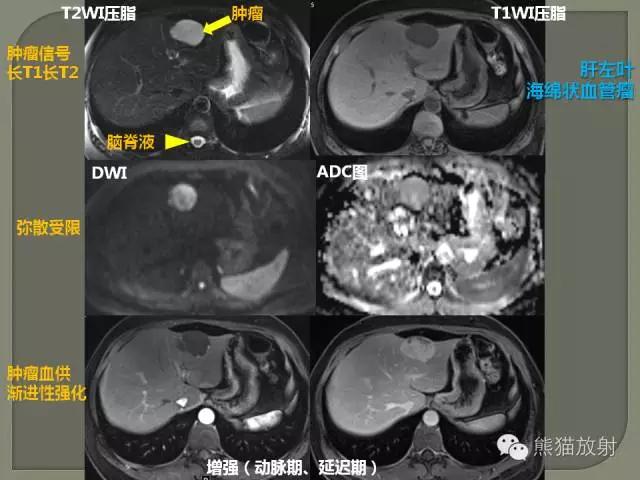 如何简单理解、认识MRI图像