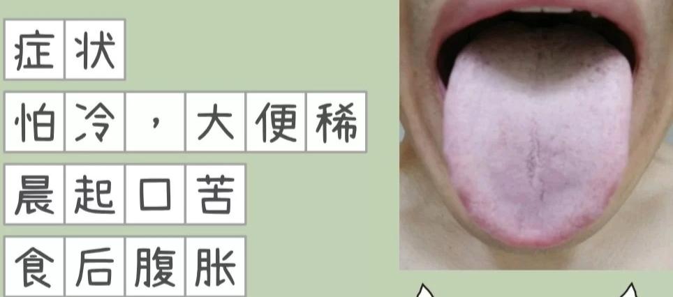 便秘大便干燥像羊便什么原因,便秘但是大便溏稀是怎么回事