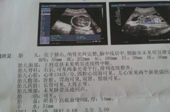 b超单上的宝宝数据,b超单上的这两个数据表示什么