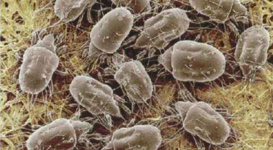 脸上有螨虫的最佳治疗方法,脸上毛孔堵塞长螨过程