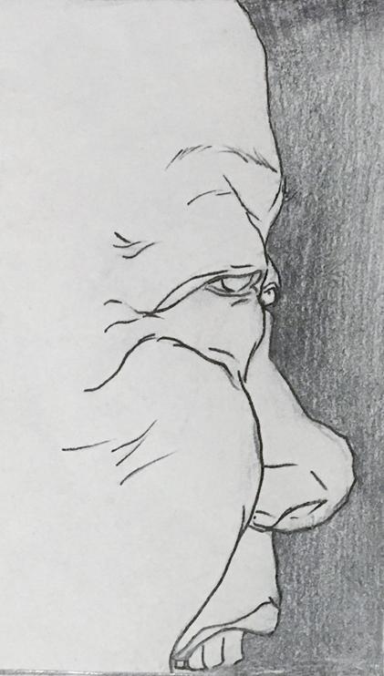 脸红肿掉头发口腔溃疡是什么病,脸长溃疡