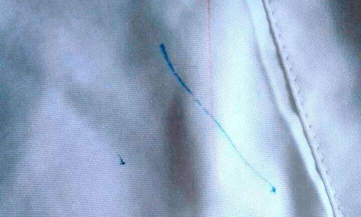 用84怎么去除白衣服上的顽固污渍,棉白衣服上的污渍怎么去除小窍门