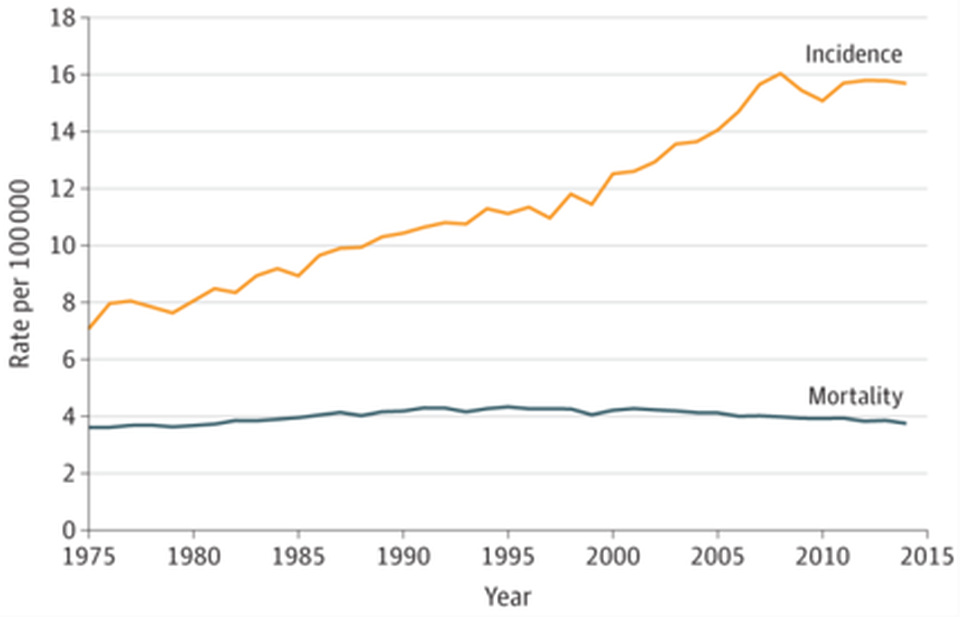 美国癌症发病率死亡率逐年下降,美国肾癌最新治愈消息