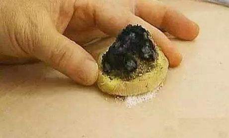 身体寒凉艾灸应该在什么时间,身体寒怕冷艾灸哪个穴位啊