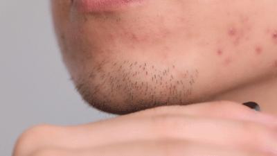 小米生态链剃须刀怎样拆解,小米生态链做出卡片剃须刀