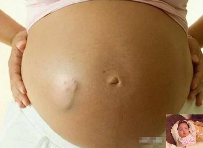 准妈妈肚子,孕早期肚子咕咕响代表什么意思