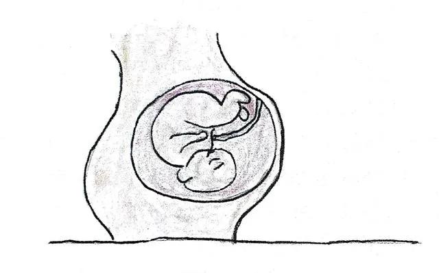 光动力治疗三个必要条件,为什么光动力治疗需要三次