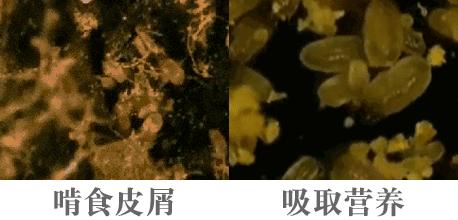 男生螨虫脸特征,螨虫脸的特征