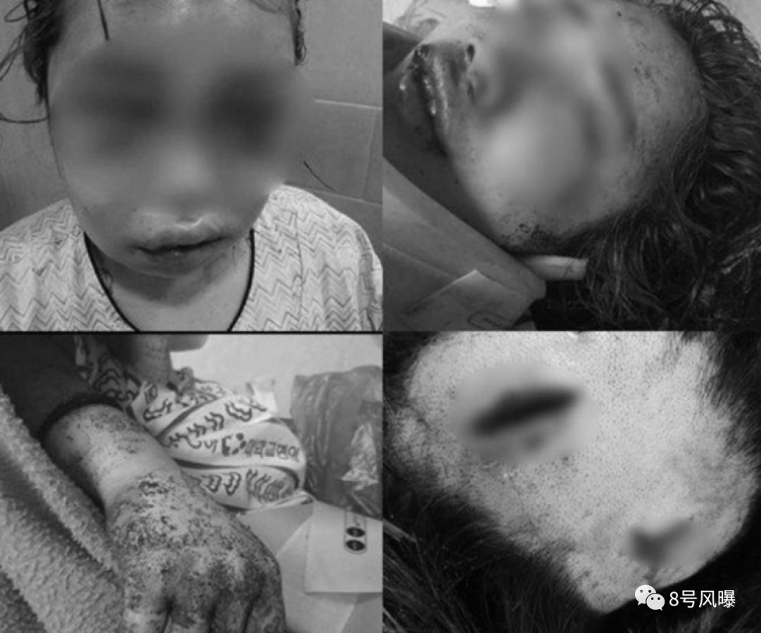 男子疑性侵15岁少女被打后续,19岁女孩遭韩国男子暴打