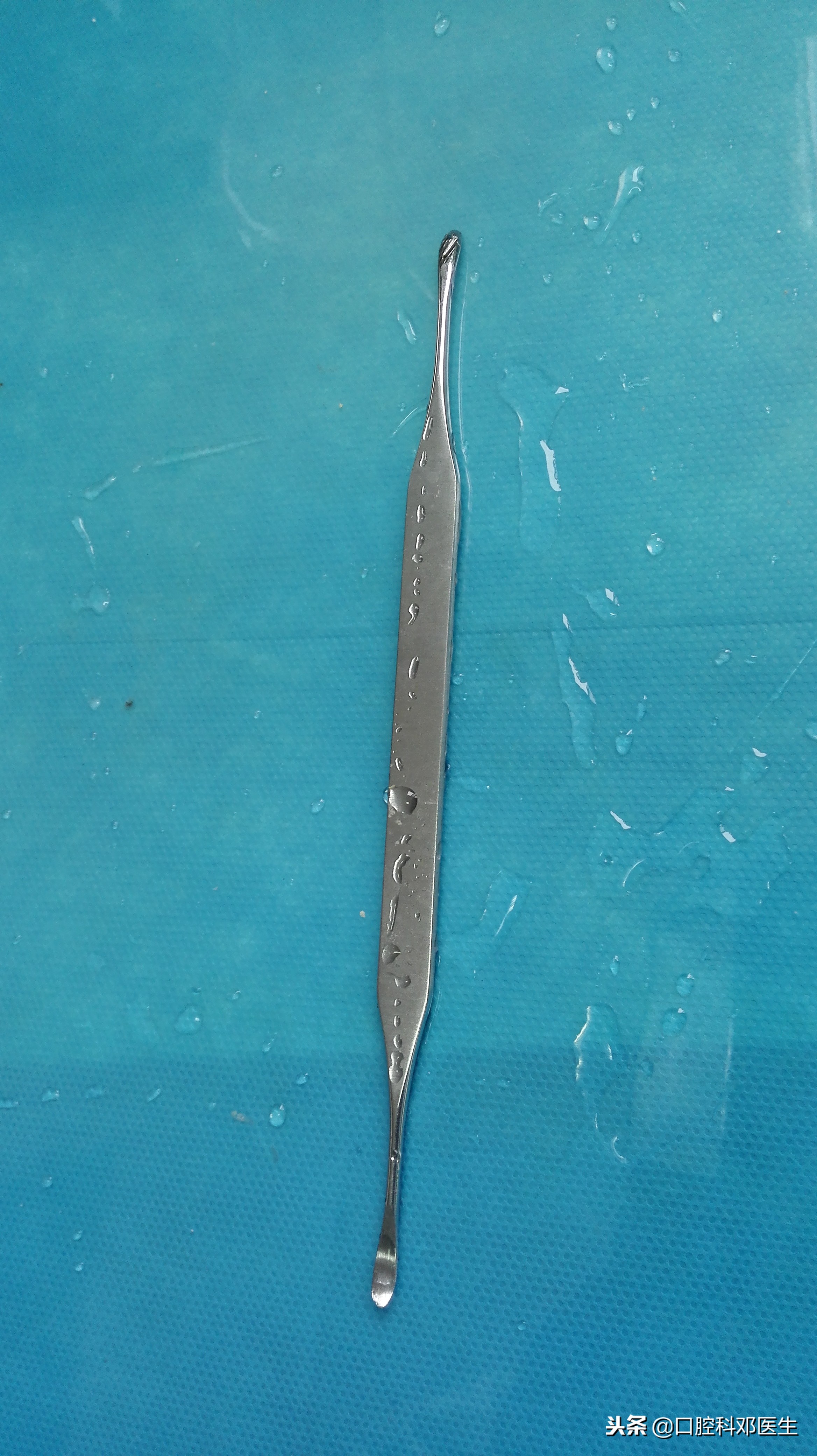 拔牙前注意事项与禁忌症智齿,拔牙齿前需要准备什么物品