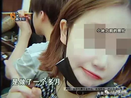 杭州漂亮女孩扎马尾头皮一下秃了四块！她怀疑那次在理发店……