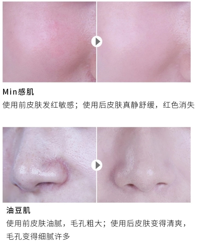 你还为皮肤问题而发愁吗,你的皮肤问题能拖多久