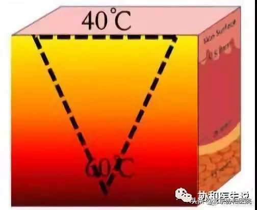 40岁的女人整形手术,40岁女性适合的身体整形医美项目