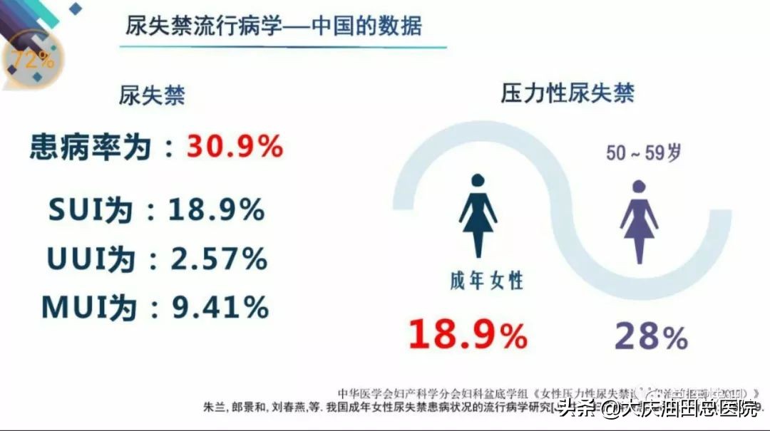 年轻女性尿失禁的3大主因是什么,大龄女性尿失禁的症状有多少个