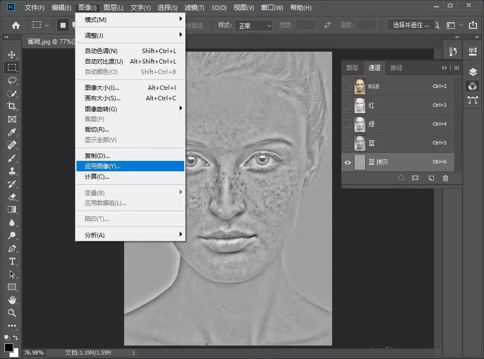 祛除脸部雀斑最有效的方法,有什么日常方法可以去除脸上雀斑