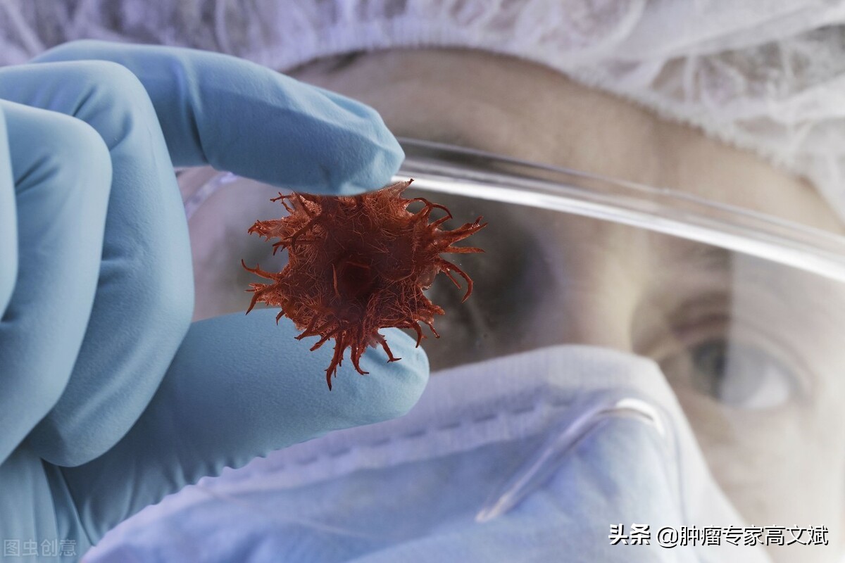 胰腺癌手术复发转移看什么,胰头癌手术后复发转移的症状