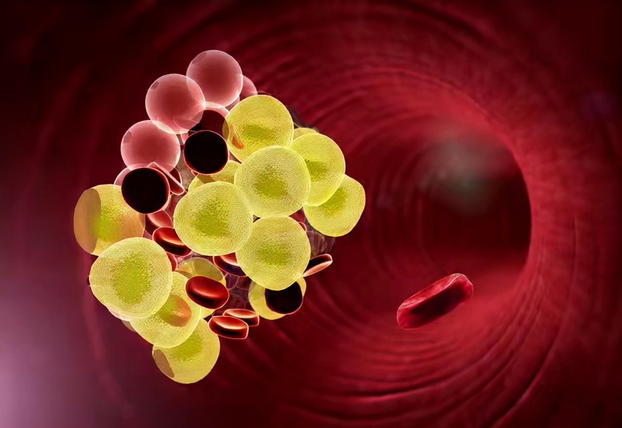 老是犯困是怎么回事怎么治,一直犯困要注意什么