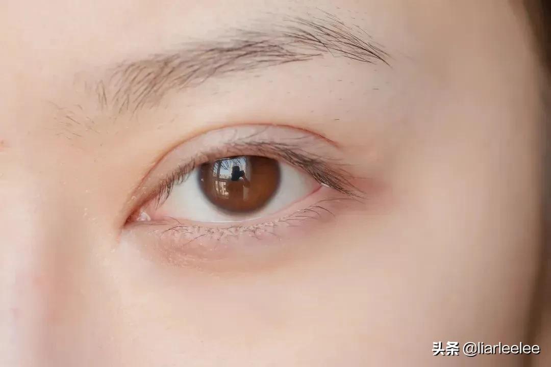 眼角皱纹最显老要注意防晒,眼角皱纹去皱最有效的方法