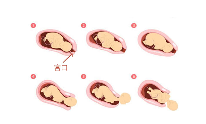 开宫口十指胎儿进入产道了吗,开宫口是顺产的必备条件吗