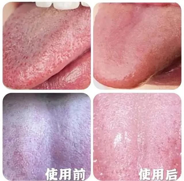 一张嘴就臭是咋回事,刷牙不管用的口臭怎么治