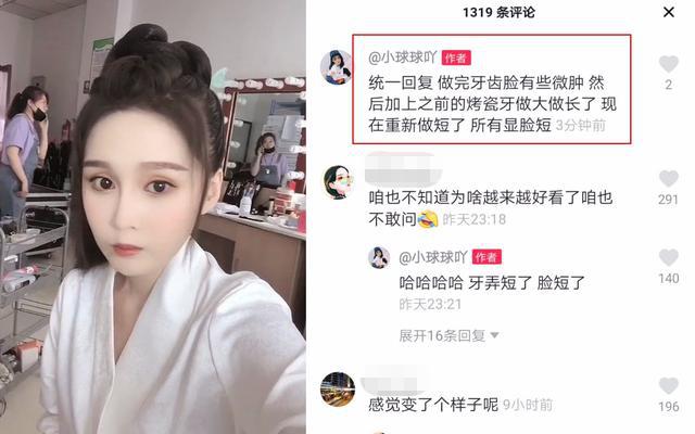 赵本山女儿自曝30万整容,赵本山女儿整容被质疑