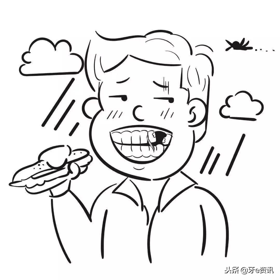 给你讲述最真实的种植牙过程,一张图可以告诉你各种牙套的区别