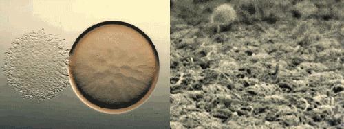 儿童金黄色葡萄球菌是怎么感染的,金黄色葡萄球菌的致病物质