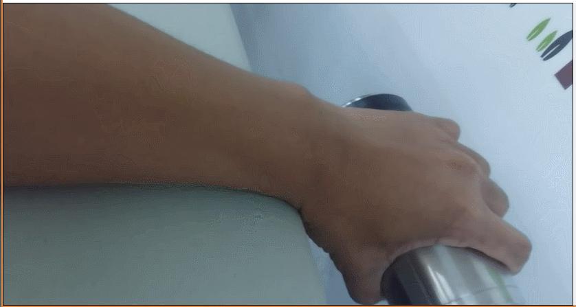 网球肘能自我恢复吗,网球肘病因的解剖学研究