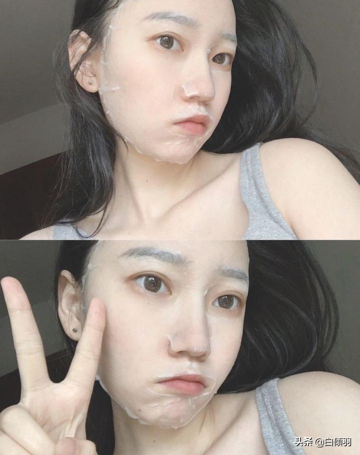 青春期满脸痘痘怎么治,脸上长痘痘心里自卑怎么办