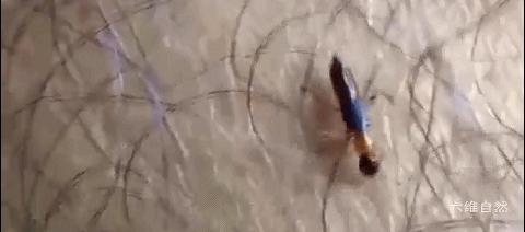 隐翅虫可以用手去拍打吗,拍打隐翅虫多久会有反应