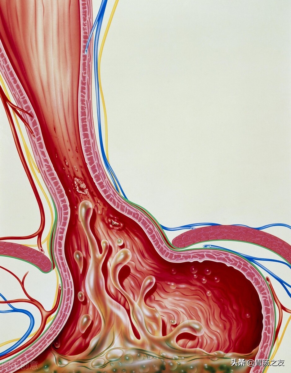 喝粥养胃之后胃更不好,喝粥养胃还是伤胃真相让人吃惊