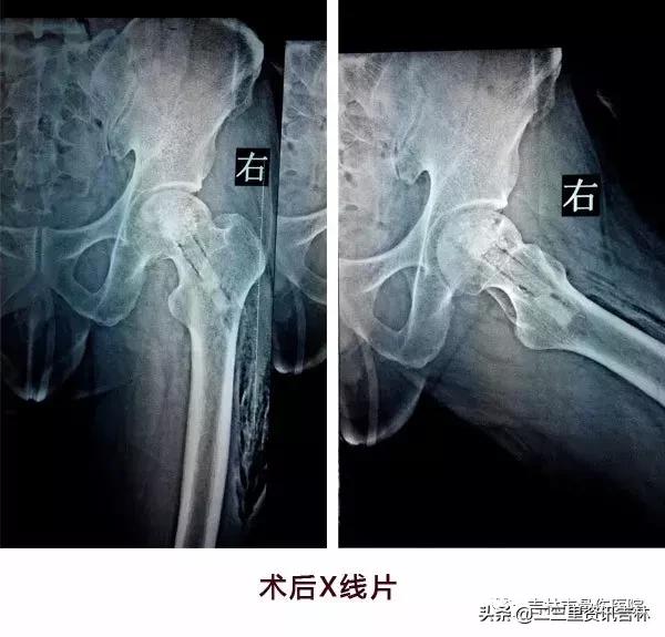 从医30余年，他治疗数以万计骨伤骨病患者