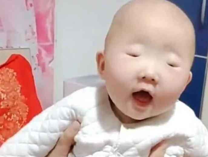 全网眼睛最小宝宝火了，李荣浩都要甘拜下风，网友：芝麻吃多了？