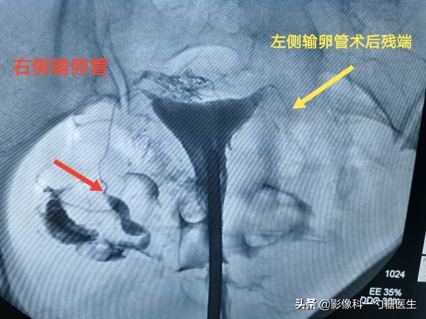 从14岁到17岁,从14岁到22岁