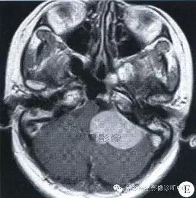 这些部位的黑色素瘤，您会诊断吗？