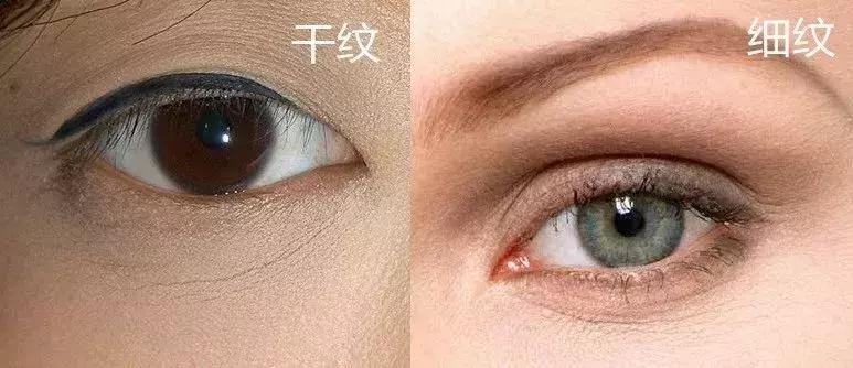眼部护理大揭秘改善眼纹,眼部眼纹保养