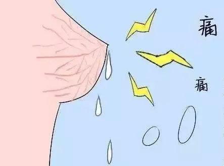 孕妈妈们哺乳期乳头皲裂受伤不用怕，护理预防有妙招
