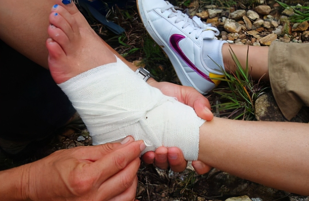 崴脚不当回事小心遗憾终生,崴脚时踝关节容易损伤的位置