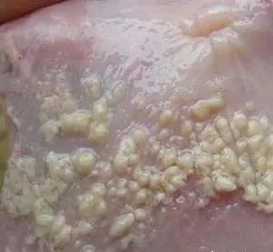 念珠菌病要怎么预防,鸡白色念珠菌感染症状及用药图片