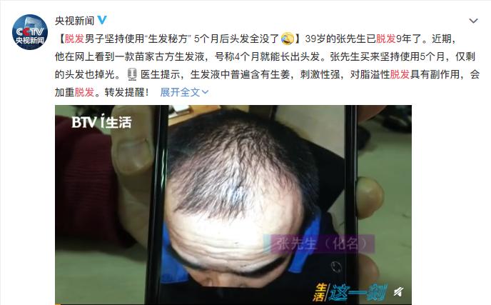 秃头少女拯救世界,秃头女孩的救命方法