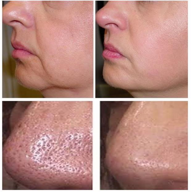 靠护肤品真能缩小毛孔吗,护肤品是怎么让毛孔缩小的