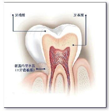 牙本质过敏的临床表现预防和治疗,牙本质过敏症治疗方法是